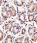 PACSIN2 Antibody (C-term)